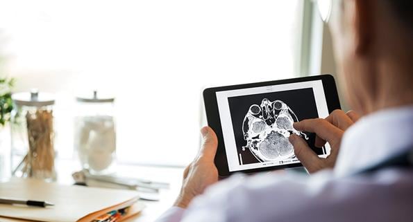 doctor examining a brain scan on a tablet